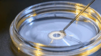 Egg Donation