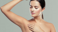 Arm Lift